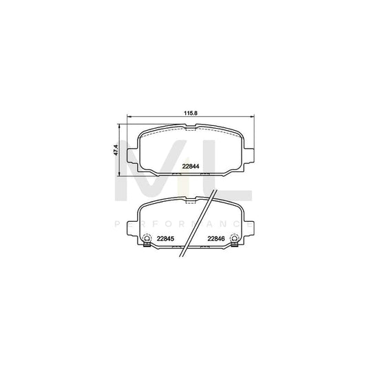 Hella 8DB 355 039-411 Brake Pad Set For Jeep Compass (Mp, M6) With Acoustic Wear Warning, With Brake Caliper Screws, With Accessories